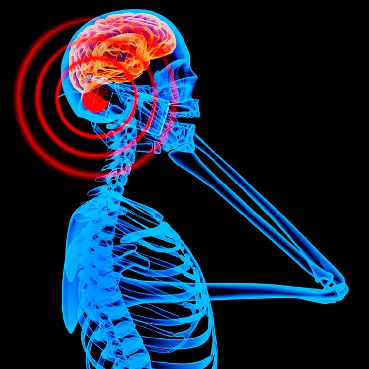 estudios sobre el efecto de la radiación móvil y el cáncer