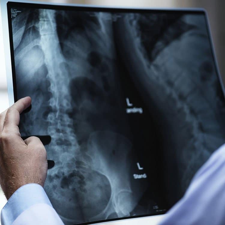 estado del mercado de la telefonía